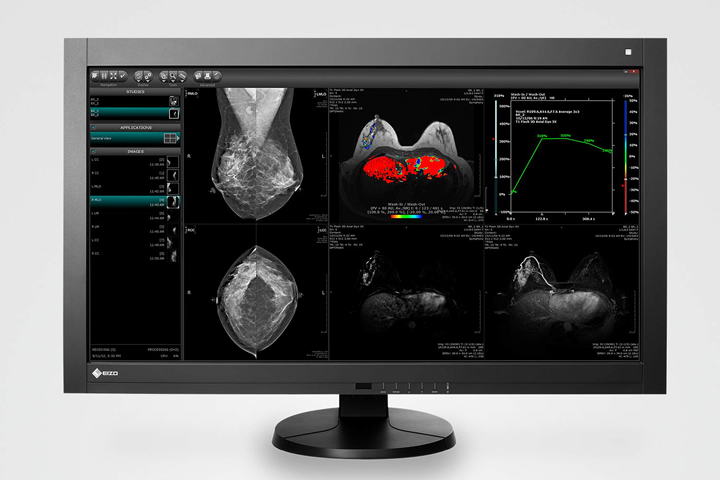 EIZO monitores - Equipamiento para Sanidad